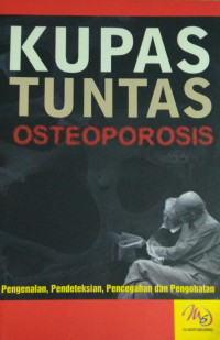 Image of Kupas tuntas osteoporosis
